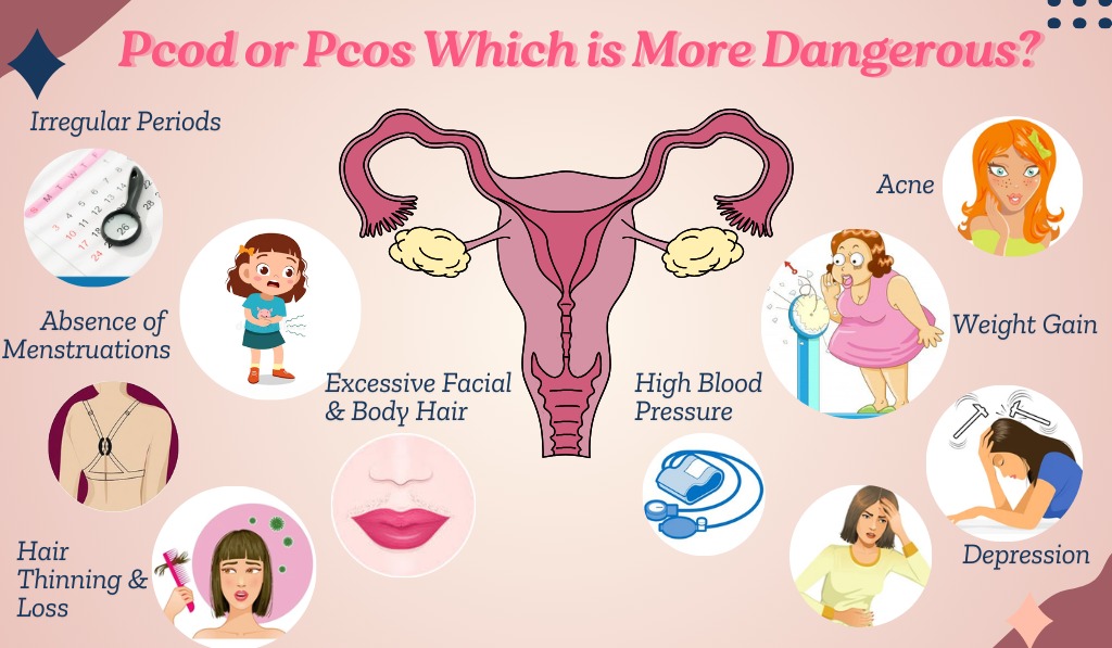 PCOD and PCOS Which is More Dangerous